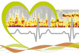 Heart rate variability in a lifrefire spectrogram