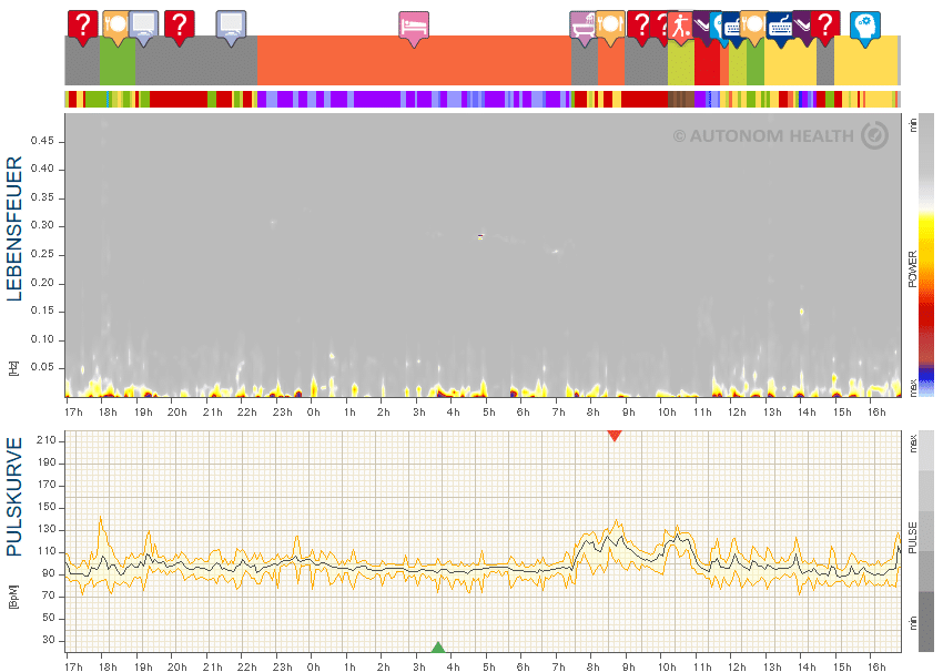 Abb.15: Herr E., 46, im Burnout