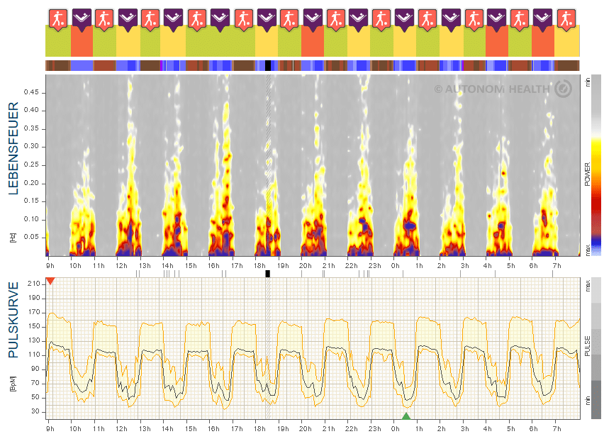 Abb.18: Intensives Intervalltraining, 29
