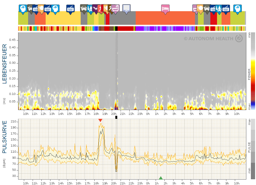 Abb.17: Hobbysportlerin, 31, Übertraining