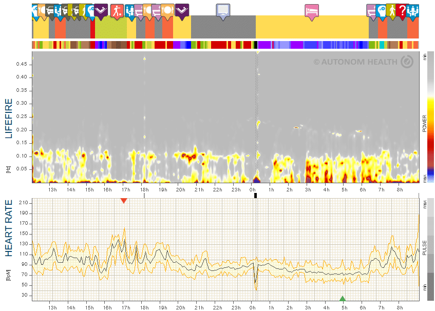 Fig. 14: Mr. B., 48, heading towards burnout