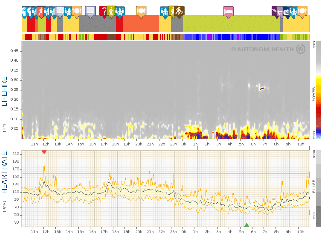 Fig. 1: Significant state of exhaustion in the Lifefire® spectrogram
