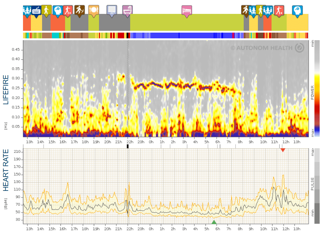 Fig. 1: Learn about and interpret the HRV spectrogram/lifefire® in HRV training.