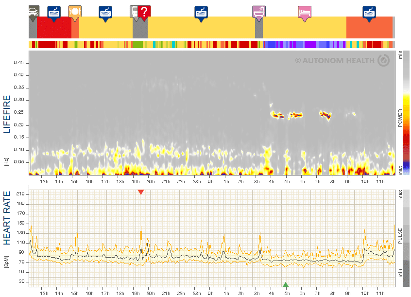 Fig. 3: Ms. S., 26, consequences of overexploitation