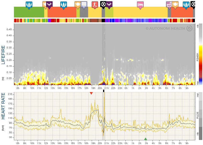 Fig. 19: Mr. P., 64, high-performing & healthy