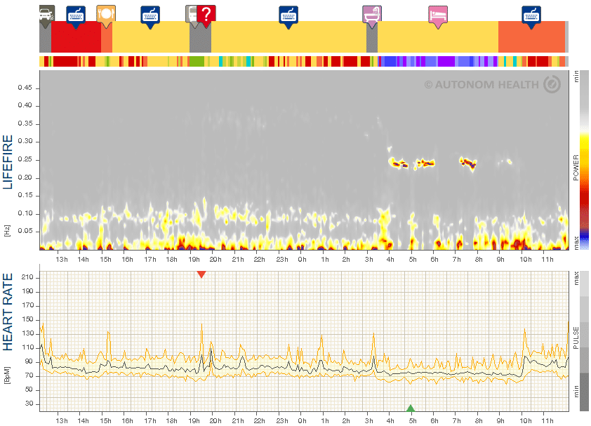 Fig. 12: Mrs. H., 47, chronically poor sleep