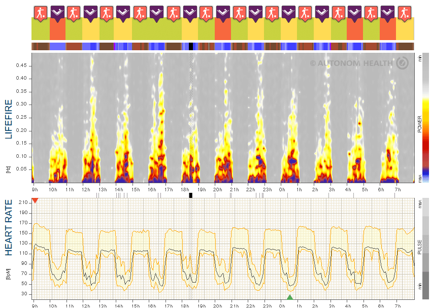 Fig. 18: Intensive interval training, 29